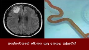 කාන්තාවකගේ මොළය තුළ දඟලන පණුවෙක්